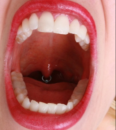 A close look of unusual Uvula piercing