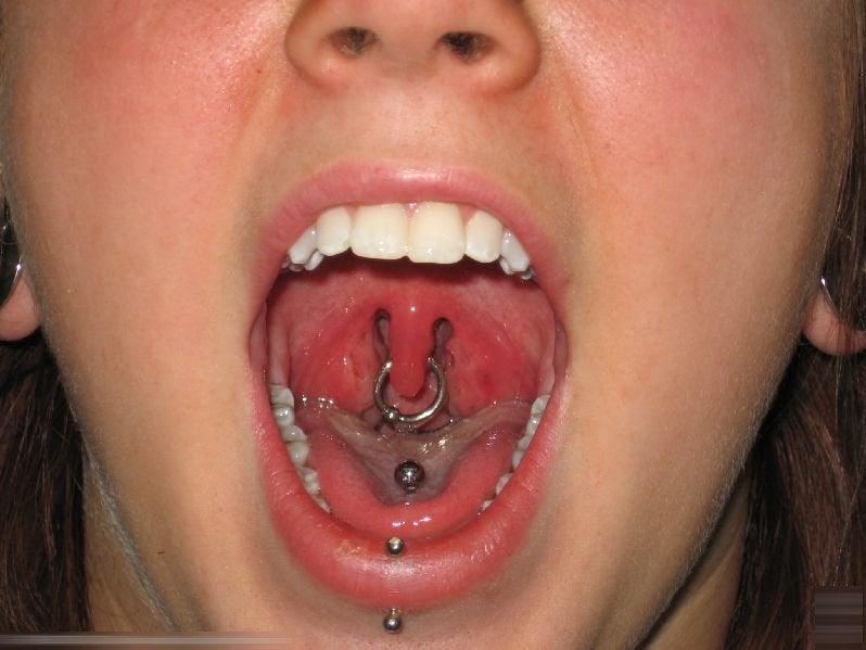 Uvula piercing