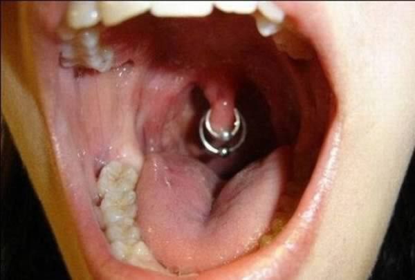 Uvula piercing with two rings