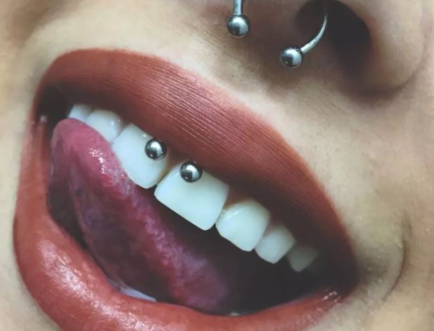 Gum Piercing Things to know
