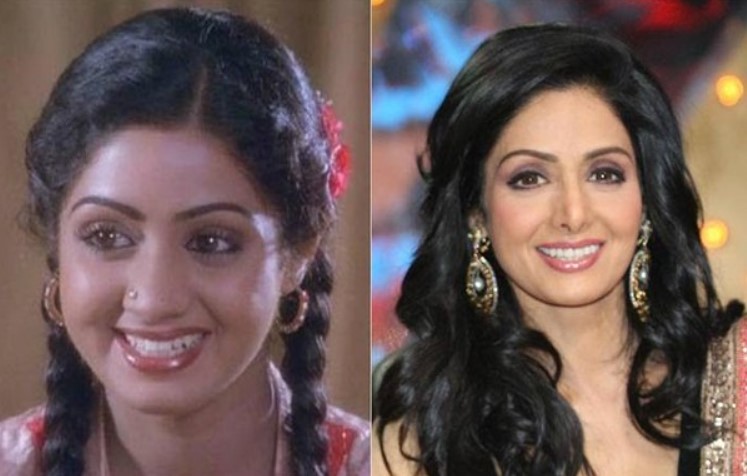 Sridevi before and after tooth implants