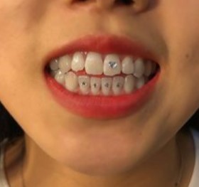 Teeth Jewellery Idea 10