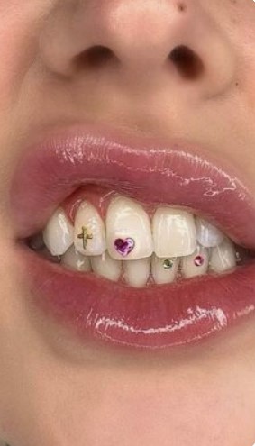 Teeth Jewellery Idea 12