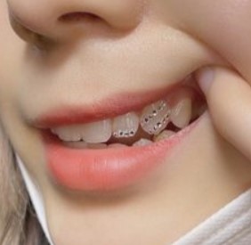 Teeth Jewellery Idea 14