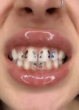 Teeth Jewellery Idea 17