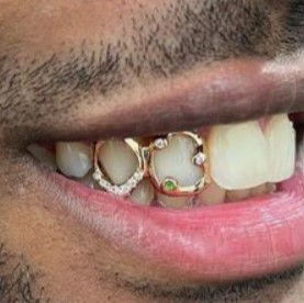 Teeth Jewellery Idea 20