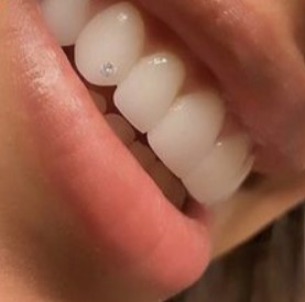 Teeth Jewellery Idea 3
