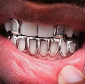 Teeth Jewellery Idea 9